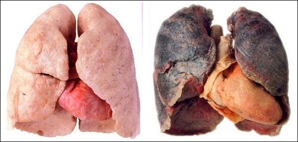 Xem thuốc lá phá hoại lá phổi như thế nào 6 Xem thuốc lá phá hoại lá phổi như thế nào 6