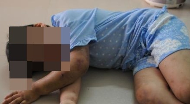 “Vòi” tiền mua ma túy, cha hành hạ, bỏ đói con 2 tuổi suốt đêm