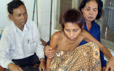 Sự thật về nữ người rừng nửa người nửa thú ở Campuchia