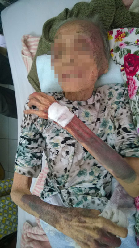 Phẫn nộ với cảnh cụ bà 94 tuổi bị con ruột hành hạ