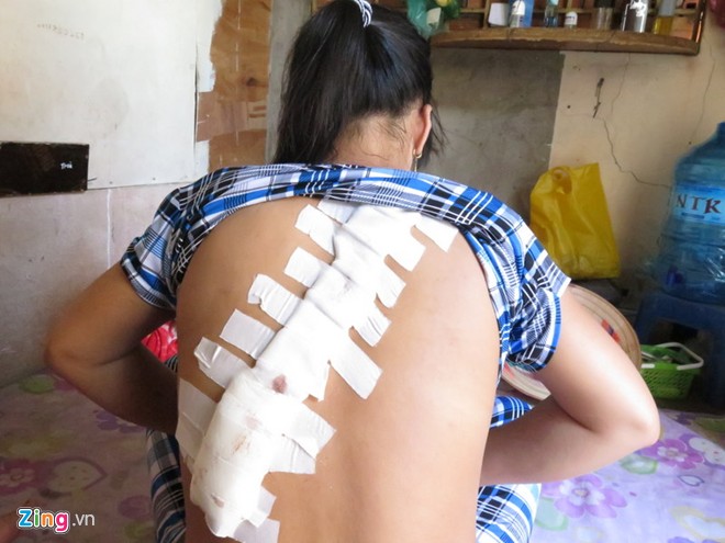 Một thiếu nữ bị giang hồ Sài Gòn chém rách lưng