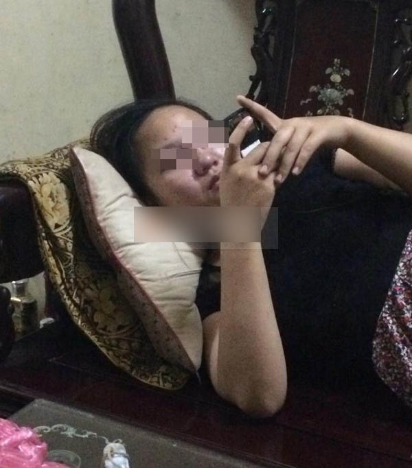 Chồng đánh vợ đang mang thai sưng tím mặt đăng lên face, cư dân mạng bức xúc