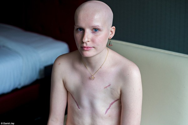 Bộ ảnh của bệnh nhân ung thư vú sau phẫu thuật gây xúc động 8