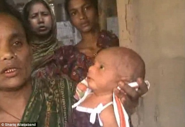 Video: 'Lang băm' túm cổ bắt bé 2 ngày tuổi tập đi để chữa sốt 2