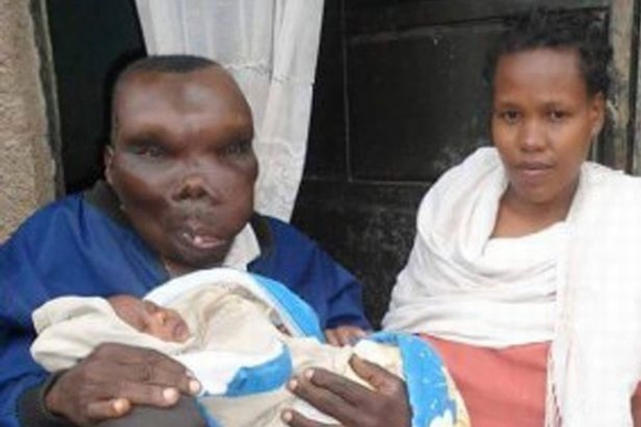 Người đàn ông “xấu nhất Uganda” chào đón đứa con thứ 8 với vợ thứ hai 1