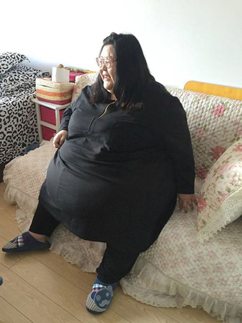 Cô gái béo nhất TQ phẫu thuật dạ dày để giảm cân 7
