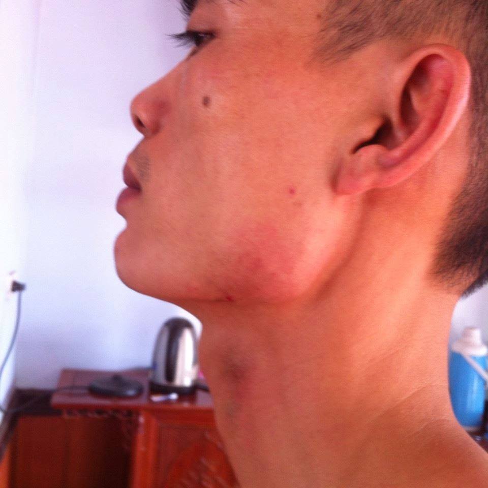 Hà Nội: Phó Công an xã bị tố đánh người vì đi vệ sinh ở ven đê