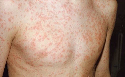 Những tác hại của việc ngồi điều hòa quá lạnh 1