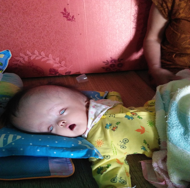 Cuộc sống đau đớn của bé gái 8 tháng tuổi mồ côi cha, cái đầu như muốn nổ tung vì căn bệnh não úng thủy - Ảnh 1.