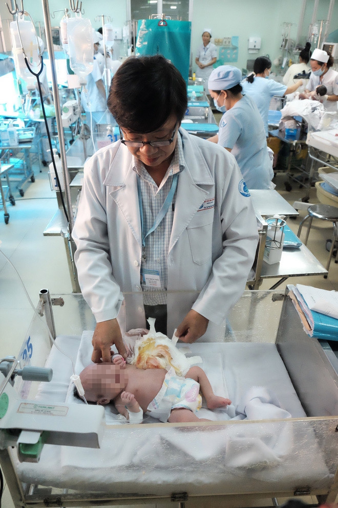 TP.HCM: Vừa chào đời, bé gái đã mang khối u khủng trên cơ thể khiến tính mạng nguy hiểm - Ảnh 6.