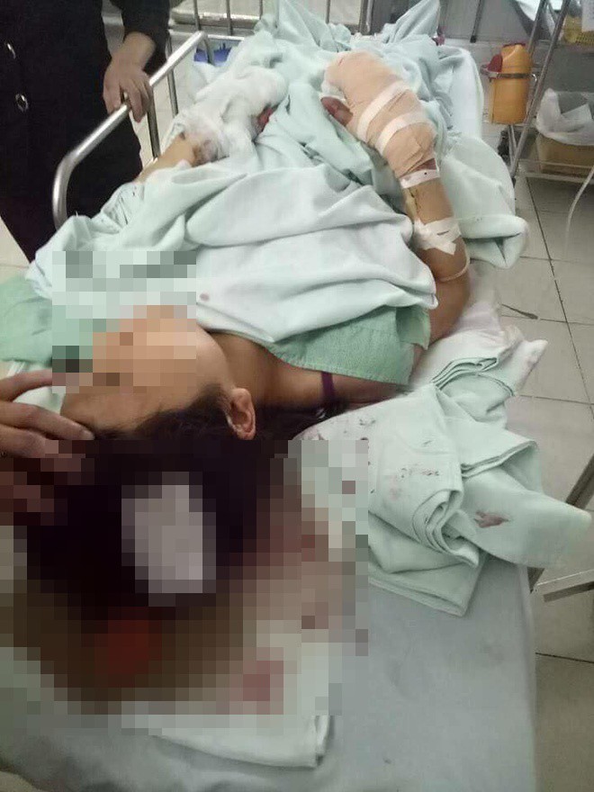 Hà Nội: Con trai chém mẹ và em gái trọng thương vì không được chia đất 1 Hà Nội: Con trai chém mẹ và em gái trọng thương vì không được chia đất 1