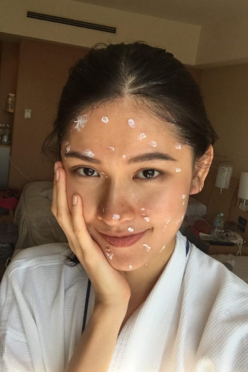 Á hậu Thùy Dung bất ngờ bị bệnh thuỷ đậu trước thềm chung kết Miss International 2017 - Ảnh 1.
