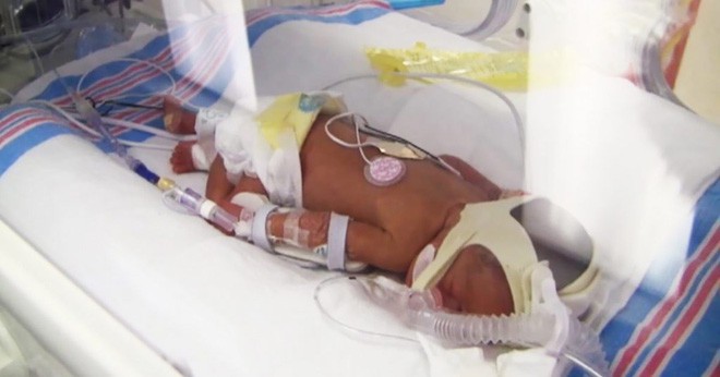 Bà mẹ 42 tuổi được chẩn đoán sinh ba, đến ngày sinh, điều bất ngờ đến nín thở đã xảy ra - Ảnh 2.
