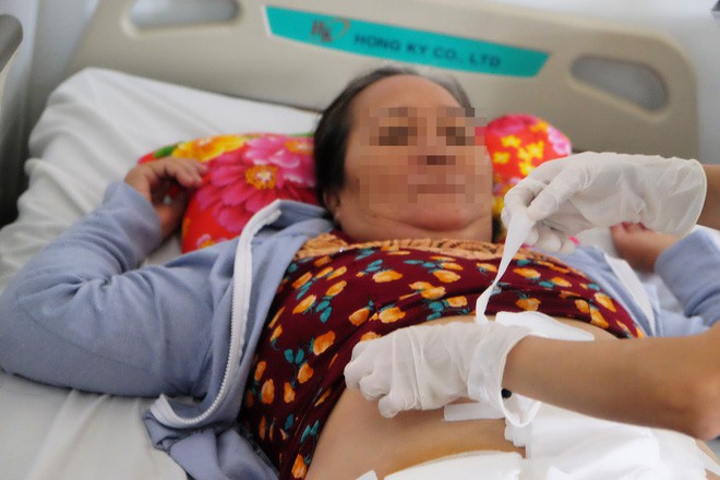 Cà Mau: Mất con trong bụng, một phụ nữ phải gắn hậu môn nhân tạo suốt 27 năm mà không biết bị cắt gần hết ruột già - Ảnh 3.