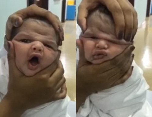 Bóp méo mặt trẻ sơ sinh để quay video câu like tàn nhẫn, nhóm y tá bị sa thải ngay lập tức 1