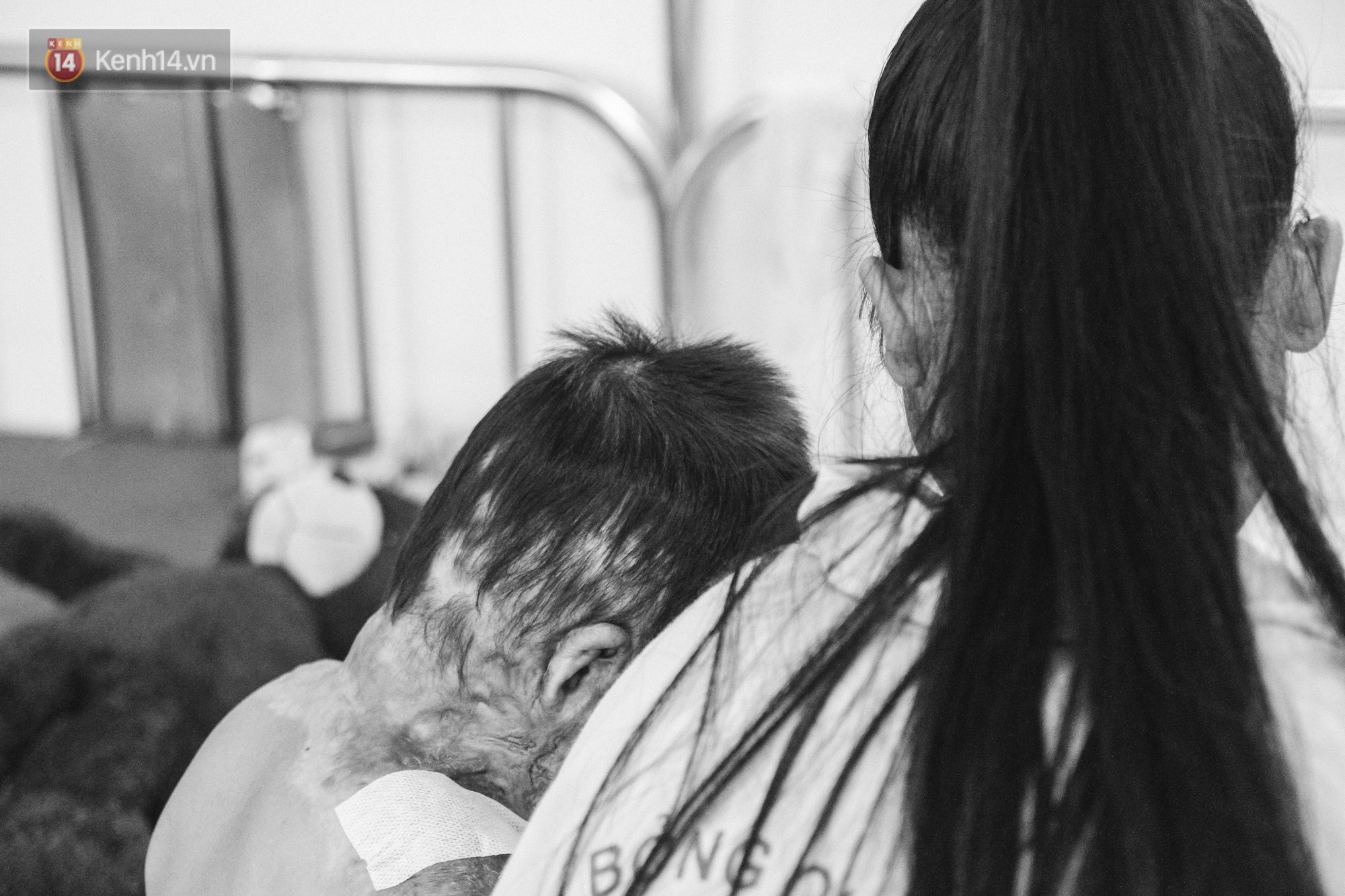 Xót xa những vết bỏng đau đớn trên người bé trai 6 tuổi: Ngày con phải cưa chân là ngày bạn bè vào lớp 1 - Ảnh 6. Xót xa những vết bỏng đau đớn trên người bé trai 6 tuổi: Ngày con phải cưa chân là ngày bạn bè vào lớp 1 9