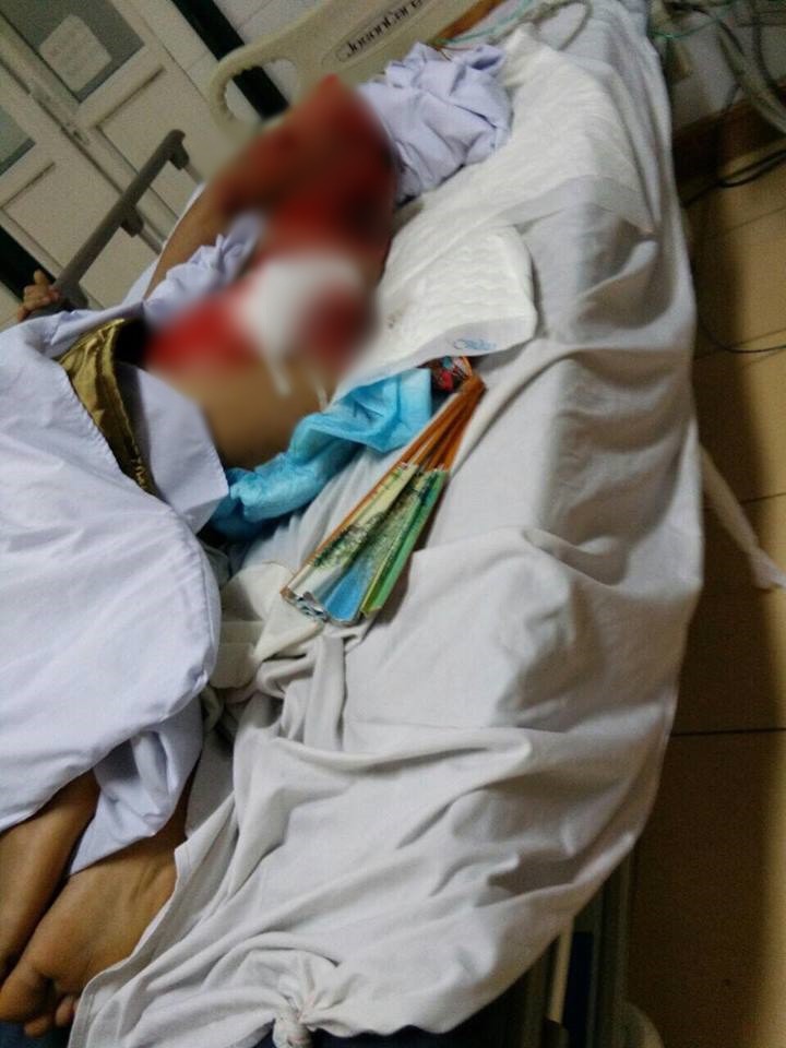 Chặn bắt tên trộm đánh xe tải đi trộm cây cảnh, người đàn ông bị xe cán trọng thương 3 Chặn bắt tên trộm đánh xe tải đi trộm cây cảnh, người đàn ông bị xe cán trọng thương 3