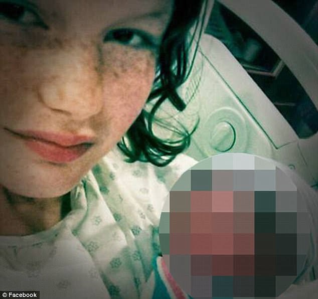 Bố mẹ nghiện ngập bỏ rơi, cô bé 15 ngày tuổi bị chuột cắn tới 100 nhát, tổn thương nặng ở vùng mặt - Ảnh 3.