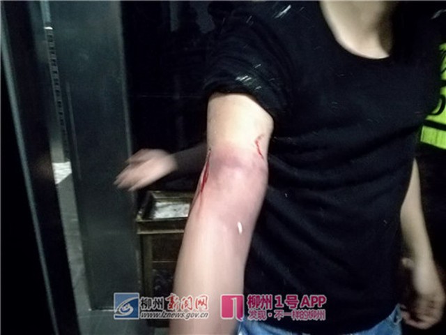 Chàng trai Trung Quốc suýt mất tay vì cố nhặt iPhone 8 rơi xuống xí xổm 2