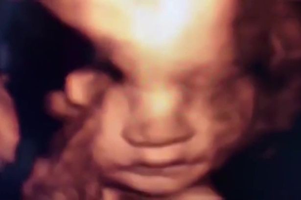 Xem tấm hình chụp thai nhi 6 tuần tuổi, người mẹ bất ngờ khi thấy hành động của đứa con trong bụng - Ảnh 1.