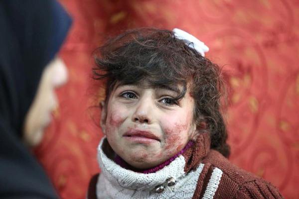 Thảm cảnh của những đứa trẻ tại thánh địa chết chóc Syria: Nỗi đau của các em vẫn chưa có hồi kết - Ảnh 4.