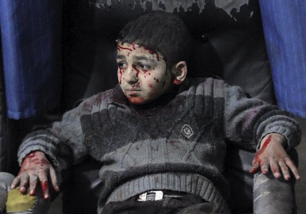 Thảm cảnh của những đứa trẻ tại thánh địa chết chóc Syria: Nỗi đau của các em vẫn chưa có hồi kết - Ảnh 9.