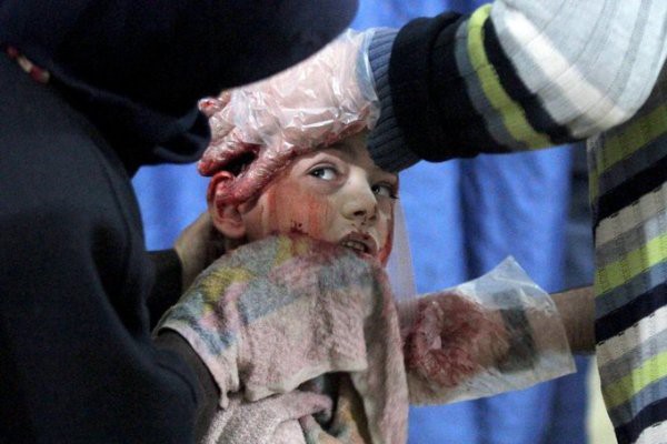 Thảm cảnh của những đứa trẻ tại thánh địa chết chóc Syria: Nỗi đau của các em vẫn chưa có hồi kết - Ảnh 12.