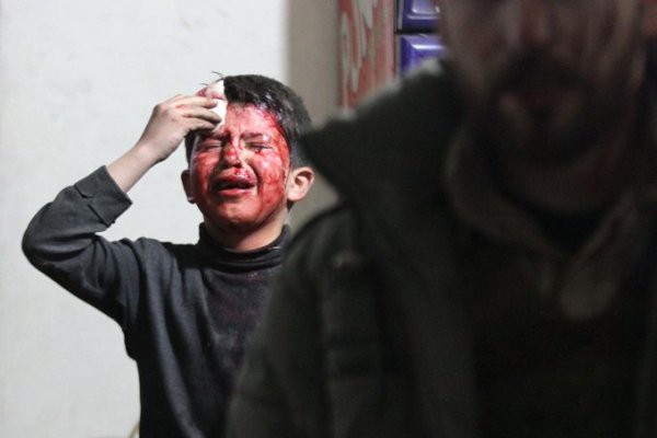 Thảm cảnh của những đứa trẻ tại thánh địa chết chóc Syria: Nỗi đau của các em vẫn chưa có hồi kết - Ảnh 16.