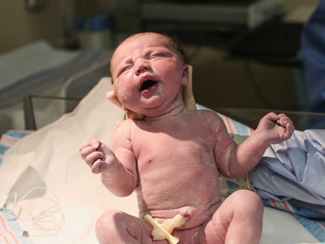 Hiếm thấy trong 80.000 ca sinh: bé gái chào đời với màng ối trùm quanh đầu - Ảnh 3.