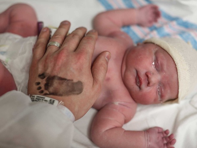 Hiếm thấy trong 80.000 ca sinh: bé gái chào đời với màng ối trùm quanh đầu - Ảnh 4.