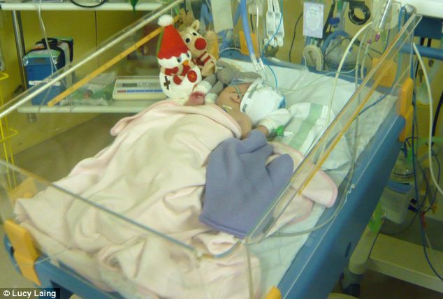 Bác sĩ nghĩ bé sơ sinh bị bầm tím nhưng 2 tuần sau, kết luận của họ khiến bố mẹ lo sợ - Ảnh 1. Bác sĩ nghĩ bé sơ sinh bị bầm tím nhưng 2 tuần sau, kết luận của họ khiến bố mẹ lo sợ 1