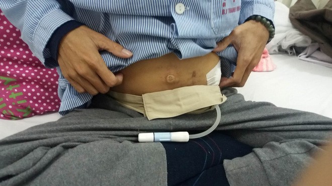 Chưa kịp đón con gái chào đời, bố nhập viện vì suy thận, một mình mẹ ngược xuôi suốt 7 năm trời lo lắng cho cả gia đình - Ảnh 6. Chưa kịp đón con gái chào đời, bố nhập viện vì suy thận, một mình mẹ ngược xuôi suốt 7 năm trời lo lắng cho cả gia đình 6