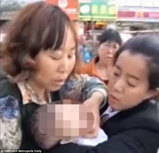 Bị táo rơi trúng đầu, bé 3 tháng tuổi nứt sọ 1 Bị táo rơi trúng đầu, bé 3 tháng tuổi nứt sọ 1
