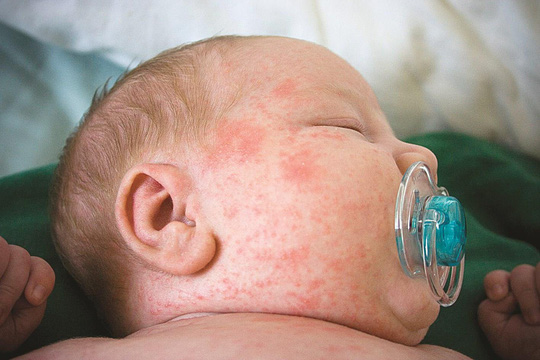 Nhiều thay đổi bất ngờ về tiêm chủng vắc-xin cho mẹ và bé  1