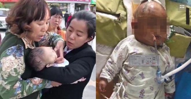 Bế cháu 3 tháng tuổi ra ngoài đi dạo, bà ngoại không thể ngờ một quả táo cũng có thể gây hại cho cuộc đời của cháu - Ảnh 1. Bế cháu 3 tháng tuổi ra ngoài đi dạo, bà ngoại không thể ngờ một quả táo cũng có thể gây hại cho cuộc đời của cháu 1