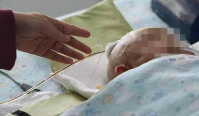 Bế cháu 3 tháng tuổi ra ngoài đi dạo, bà ngoại không thể ngờ một quả táo cũng có thể gây hại cho cuộc đời của cháu - Ảnh 2. Bế cháu 3 tháng tuổi ra ngoài đi dạo, bà ngoại không thể ngờ một quả táo cũng có thể gây hại cho cuộc đời của cháu 2