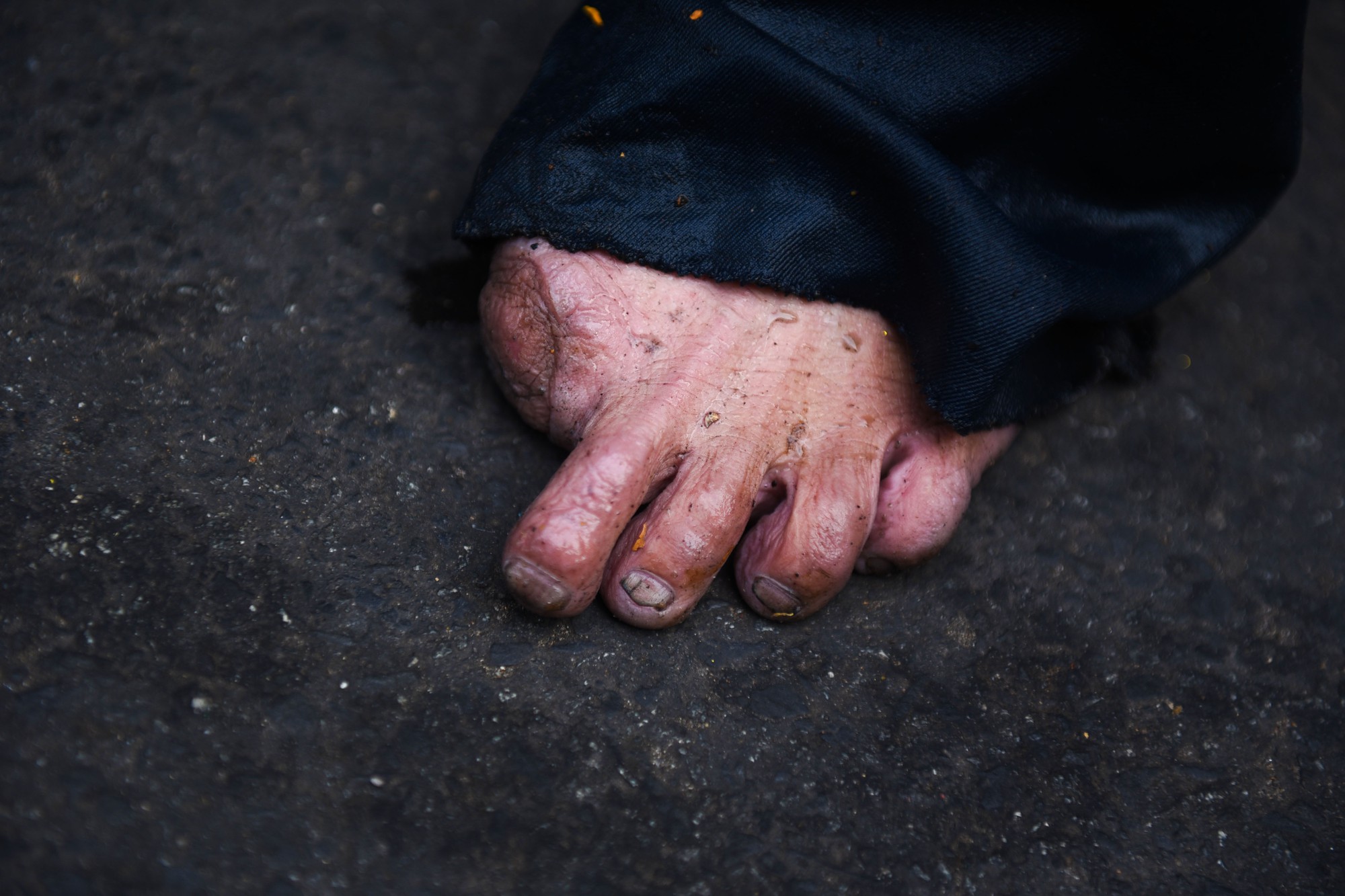 Đôi bàn chân, bàn tay không nguyên vẹn của những người làm nghề lặn ngụp trong ống cống ở Sài Gòn - Ảnh 9.