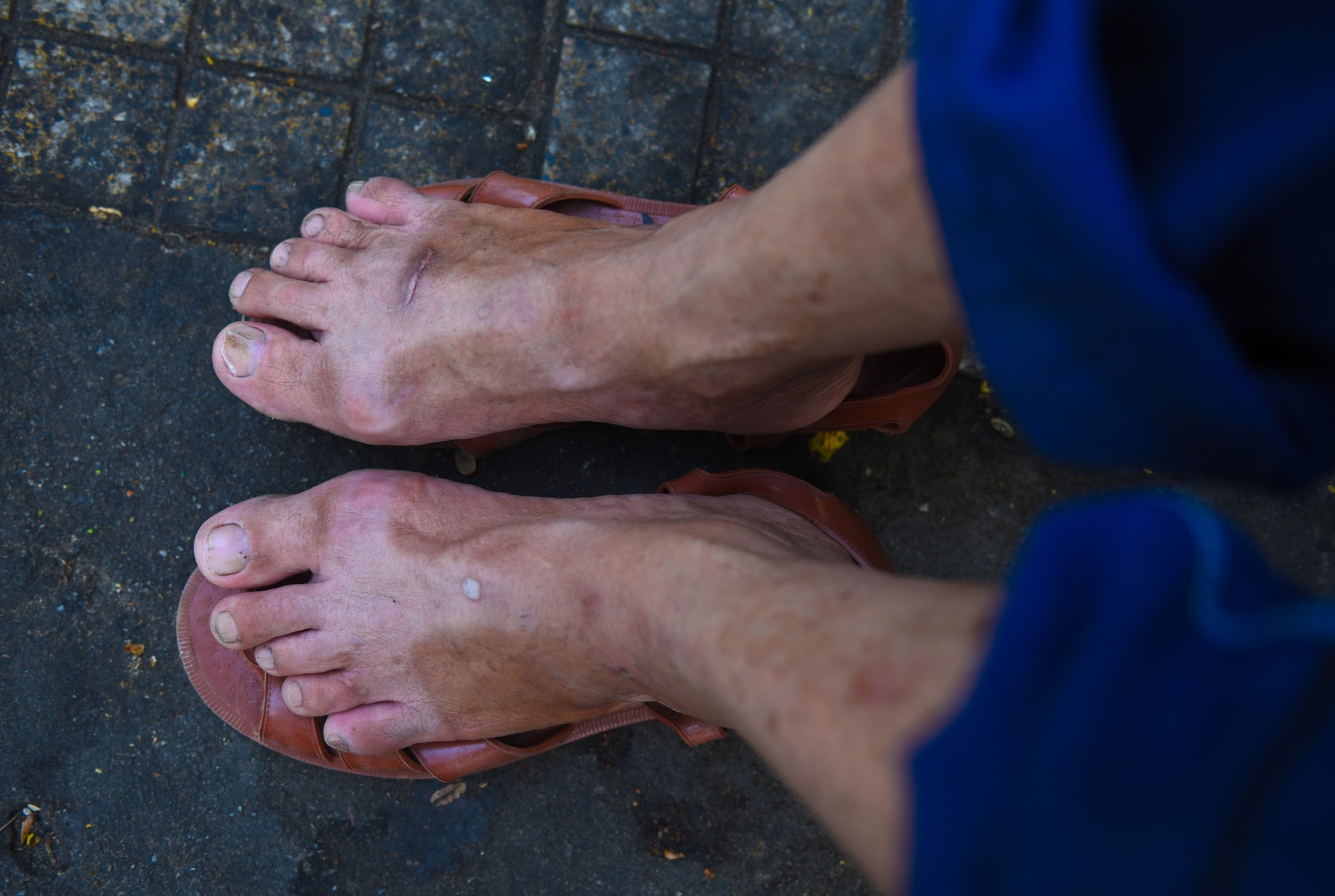 Đôi bàn chân, bàn tay không nguyên vẹn của những người làm nghề lặn ngụp trong ống cống ở Sài Gòn - Ảnh 16.