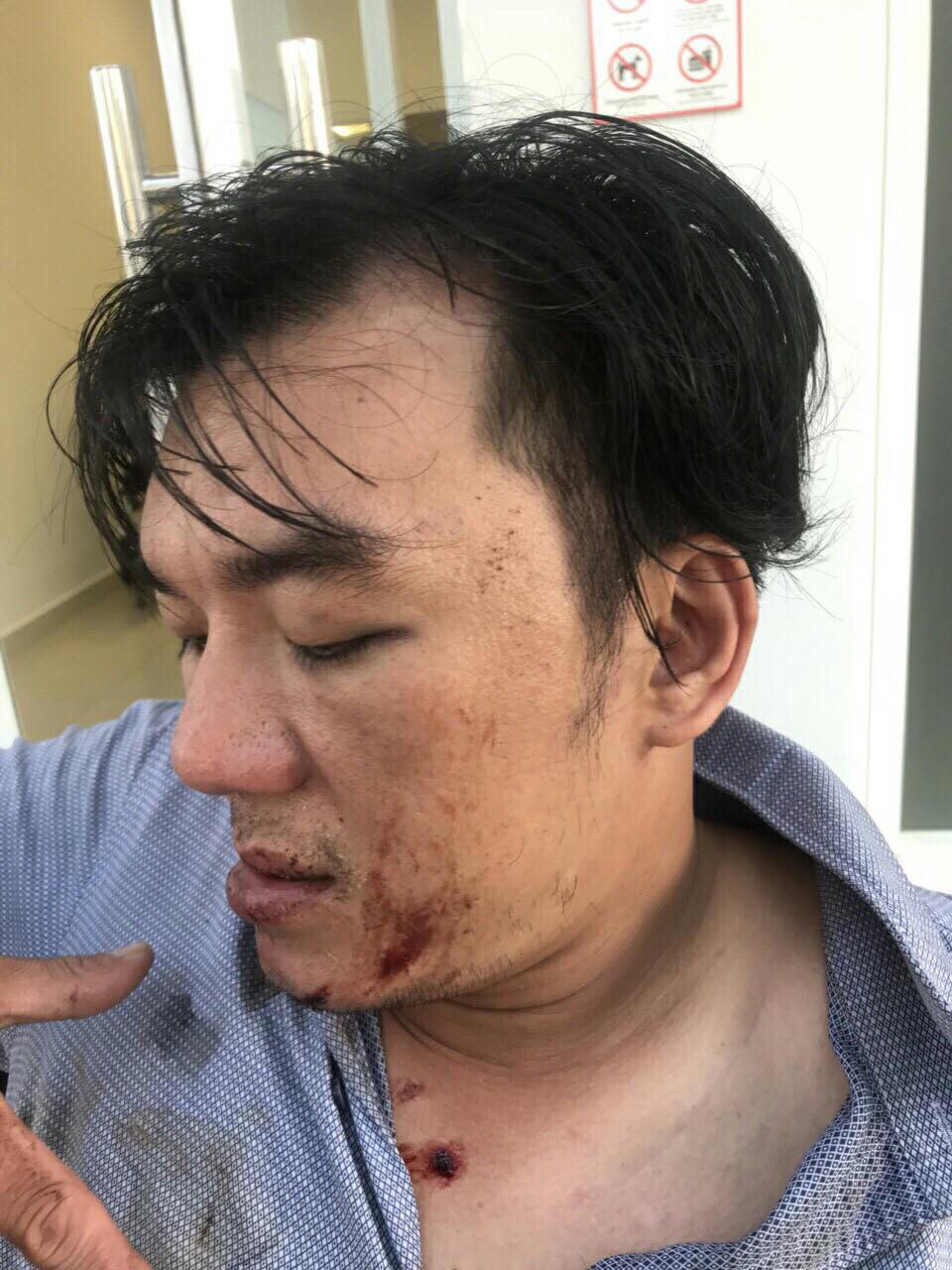 Khách tố bị nhân viên đuổi đánh dã man sau bữa ăn ở Đà Nẵng, quản lý nhà hàng nói gì? - Ảnh 1.