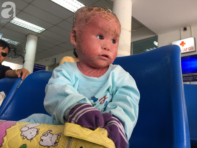 Ca sĩ Lam Trường đến thăm bé Bích - em bé bị vẩy ngứa da trăn trước khi bé nhập viện điều trị - Ảnh 7.