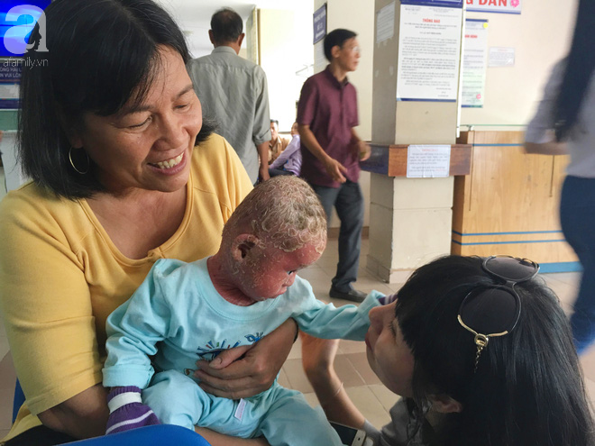 Ca sĩ Lam Trường đến thăm bé Bích - em bé bị vẩy ngứa da trăn trước khi bé nhập viện điều trị - Ảnh 6.
