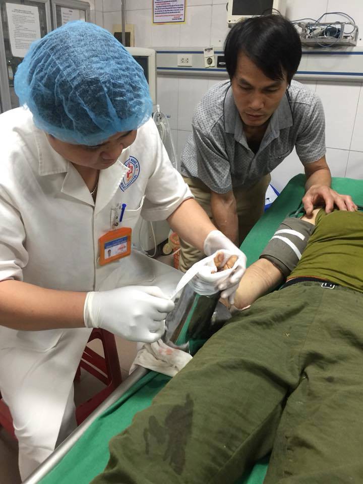 Nghệ An: Người phụ nữ mất bàn tay vì bị cuốn vào máy xay thịt - Ảnh 1.