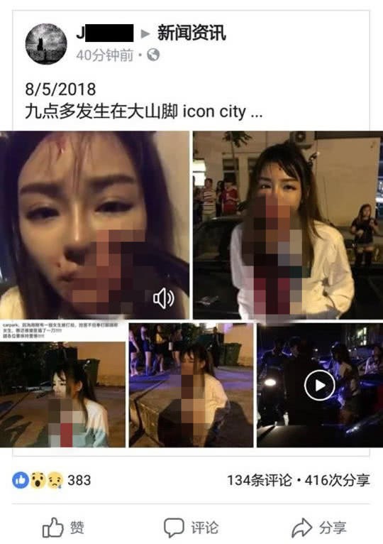 Malaysia: Bị tấn công khi đang bắt taxi, cô gái bình tĩnh đi báo công an với con dao cắm giữa mặt - Ảnh 3.