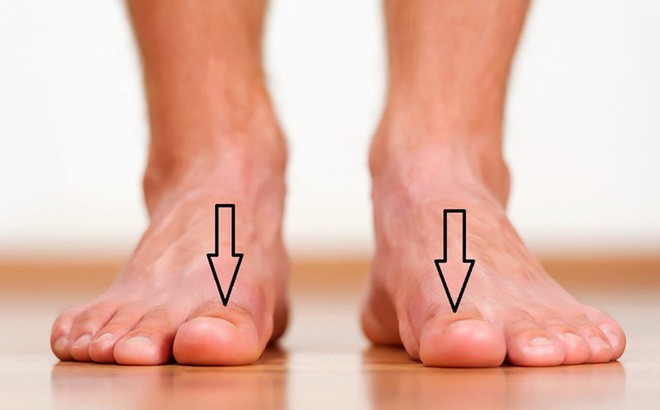 Bàn chân có 5 dấu hiệu này thì đừng chủ quan mà nên đi khám ngay - Ảnh 1.