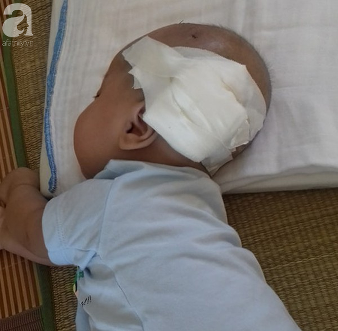 Tiếng khóc xé lòng của bé trai hơn 5 tháng tuổi mắc bệnh não úng thủy 2