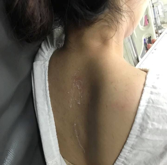 Hà Nội: Sự thật thông tin cô gái nghi bị mẹ chồng thuê người đổ keo 502 khắp đầu - Ảnh 3. Hà Nội: Sự thật thông tin cô gái nghi bị mẹ chồng thuê người đổ keo 502 khắp đầu 2