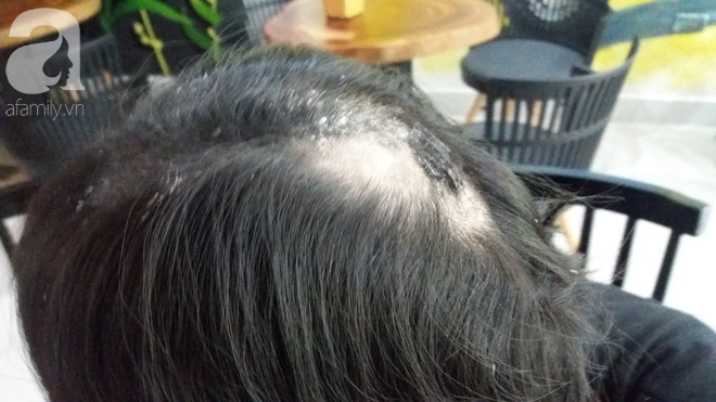 Hà Nội: Sự thật thông tin cô gái nghi bị mẹ chồng thuê người đổ keo 502 khắp đầu - Ảnh 4. Hà Nội: Sự thật thông tin cô gái nghi bị mẹ chồng thuê người đổ keo 502 khắp đầu 3