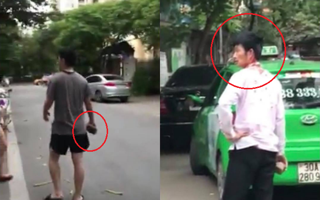 Vụ tài xế taxi bị đánh nhập viện: Sẽ xem xét khởi tố vụ án - Ảnh 1. Vụ tài xế taxi Mai Linh bị đánh nhập viện: Sẽ xem xét khởi tố vụ án 1