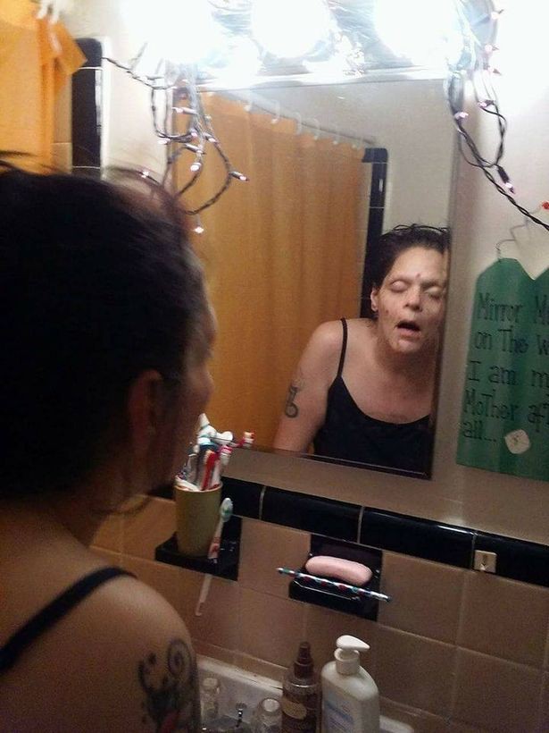 Chia sẻ hình ảnh chính mình nghiện ngập đến tàn tạ, mẹ tiết lộ cuộc hồi sinh ngoạn mục vì lý do cao cả - Ảnh 2. Chia sẻ hình ảnh chính mình nghiện ngập đến tàn tạ, mẹ tiết lộ cuộc hồi sinh ngoạn mục vì lý do cao cả 2