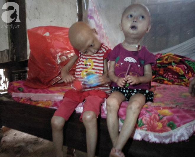 Tuyên Quang: 2 chị em gái mắc bệnh lạ khiến đầu, cổ bị nghẹo tựa 'người ngoài hành tinh' khiến ai nhìn cũng xót xa 5